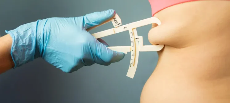 liposuction doctors in Indore, liposuction indore
