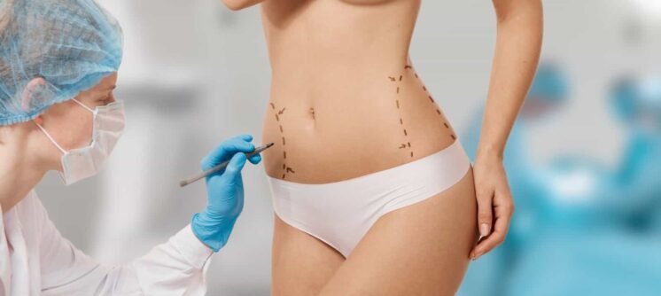 liposis suregry in indore, liposuction in indore