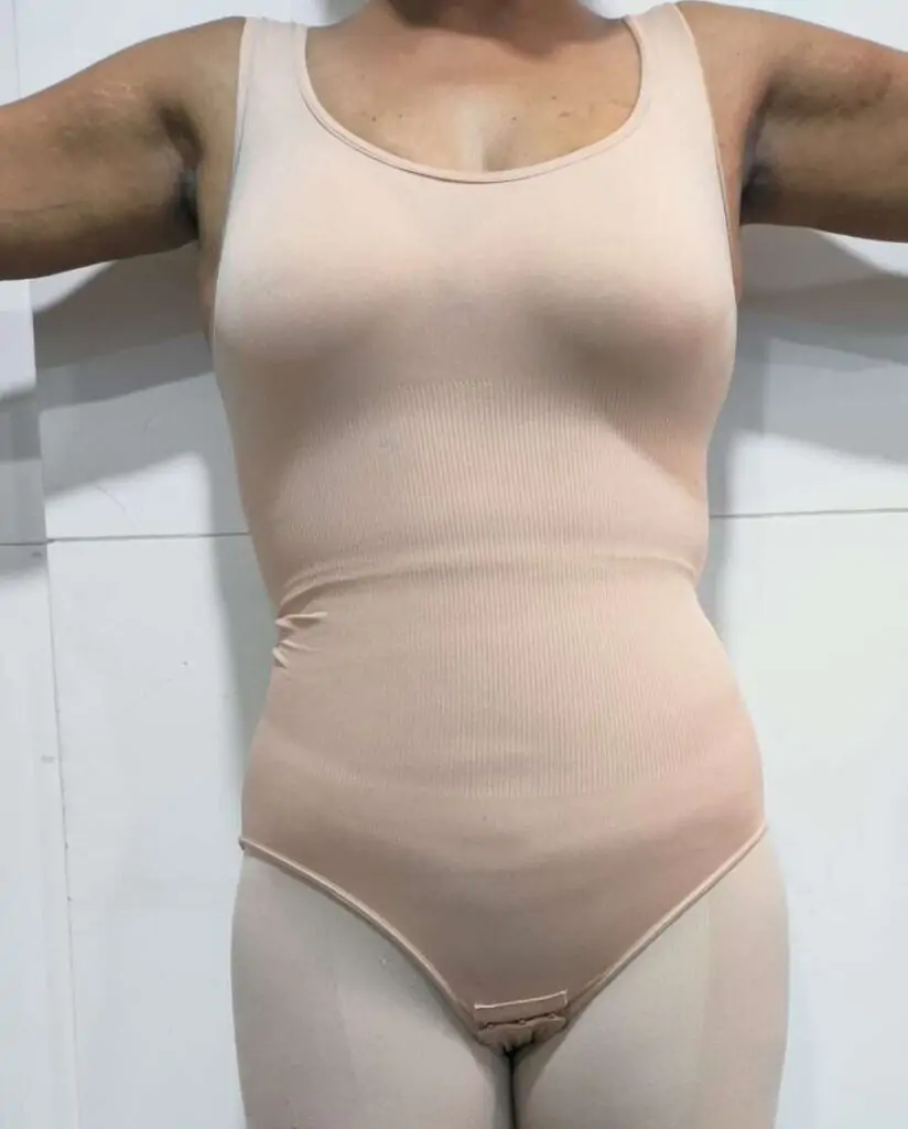 TUmmy Tuck Surgery In Indore